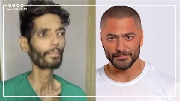 تامر حسني يدعم إبراهيم شيكا