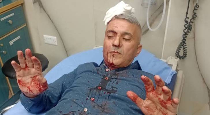 تعرض الصحفي فارس الحباشنة لاعتداء من مجموعة أشخاص في عمّان