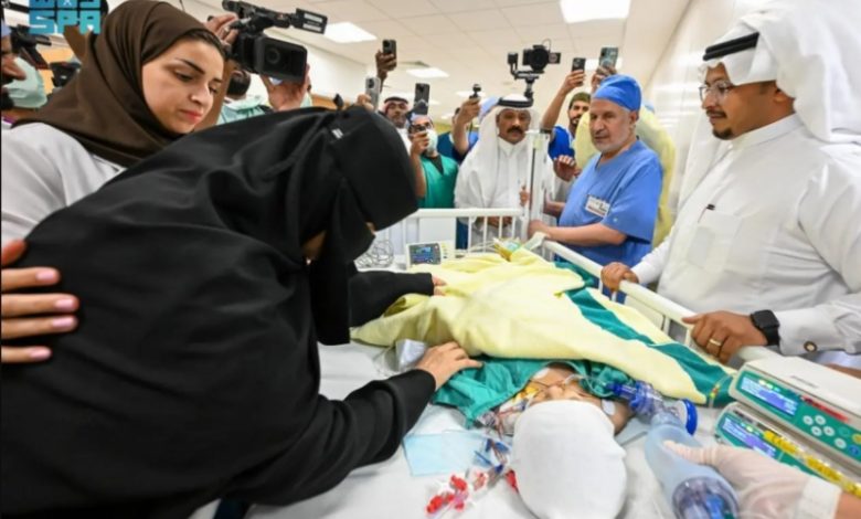 فصل التوأم الملتصق "لارا ويارا" بنجاح بعد جراحة معقدة استمرت 12 ساعة ونصف