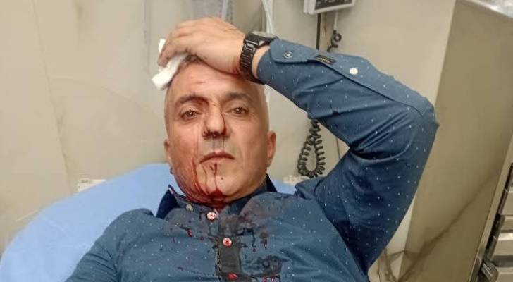 نقابة الصحفيين تدين الاعتداء على فارس الحباشنة