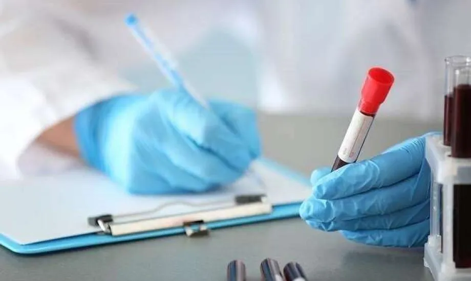 اختبار دم روتيني